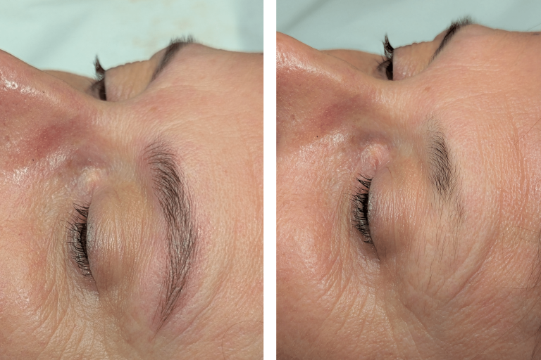 microblading-marieK microblading-marieK